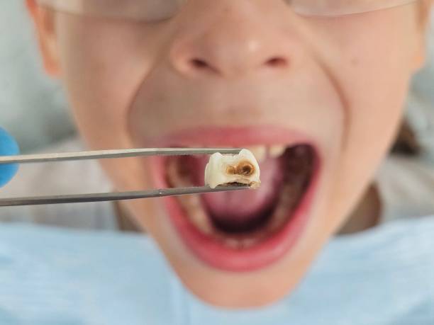 Best Dentist for Severe Toothache  in Windsor, CA